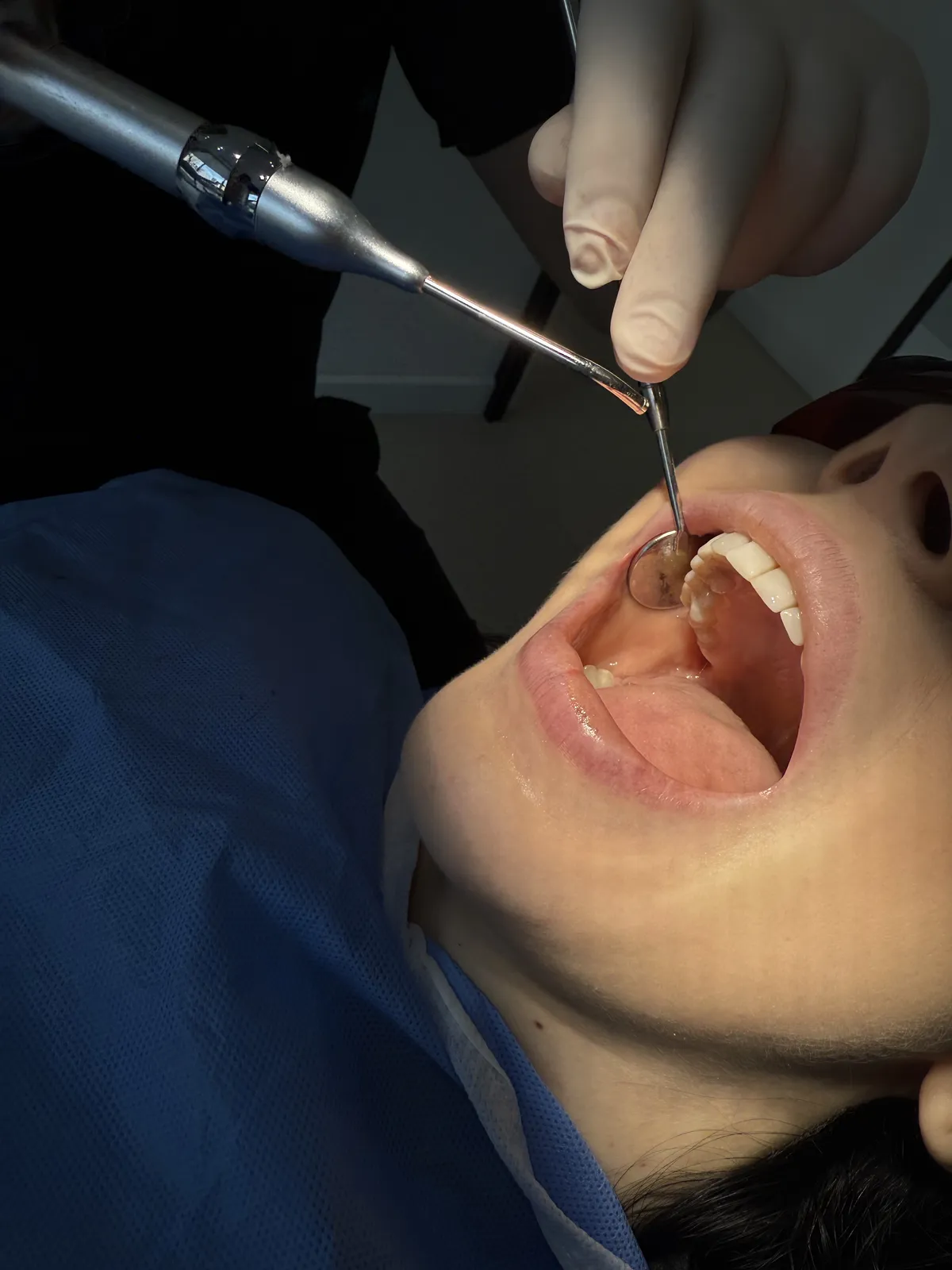 Pajisje moderne airflow në një klinikë dentare