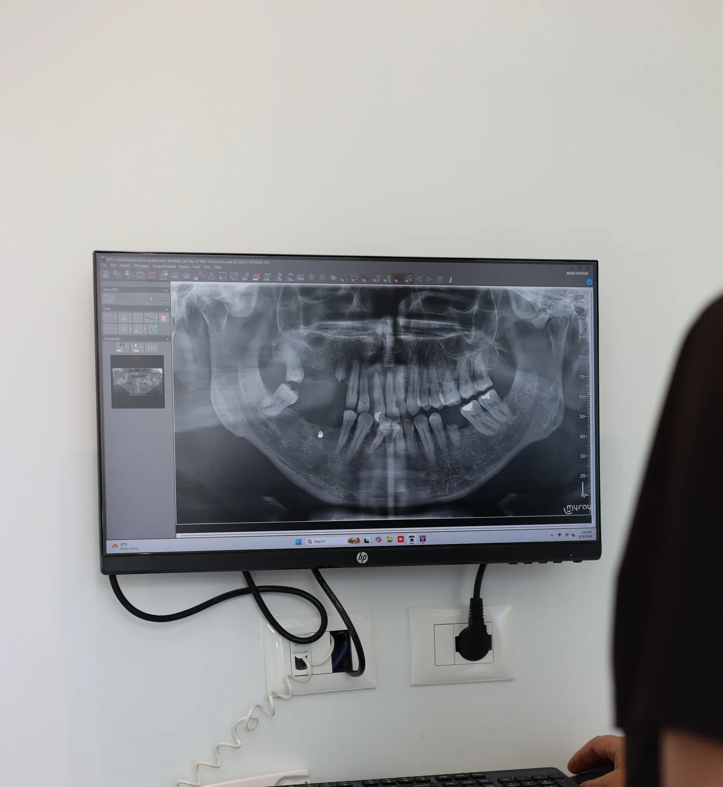How Dental Surgery Is Performed at Dental Health