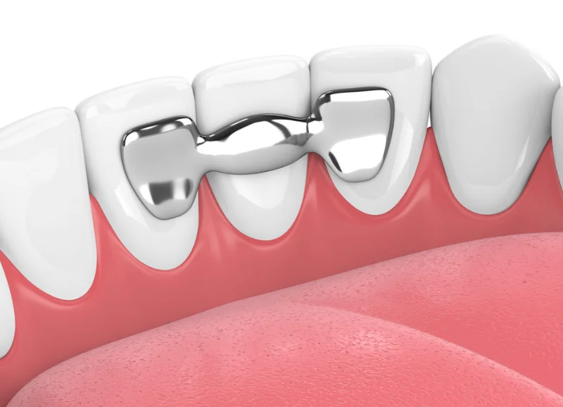 Ura Dentare